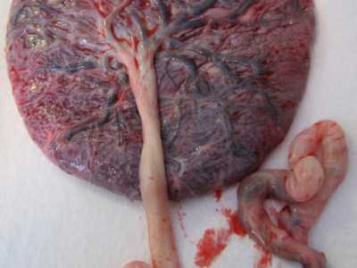 C�� chi chiede alle ostretriche di conservare la propria placenta. Per farne cosa? Incredibile a dirsi: per mangiarselo. Sembra infatti che questa �dieta� porti a numerosi benefici, migliorando la produzione di latte, aumentando i livelli di ferro dopo il parto e aiutando a evitare la depressione post partum

